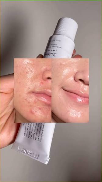 کرم ترمیم کننده و تسکین دهنده دکتر آلتیا 345 DR.ALTHEA 345 RELIEF CREAM 50 ML